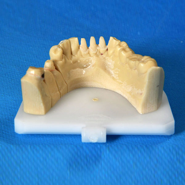 dental-select-sintamodel