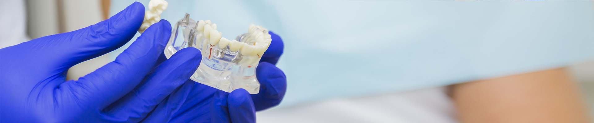 dentalselect-apparecchiature-per-odontotecnici